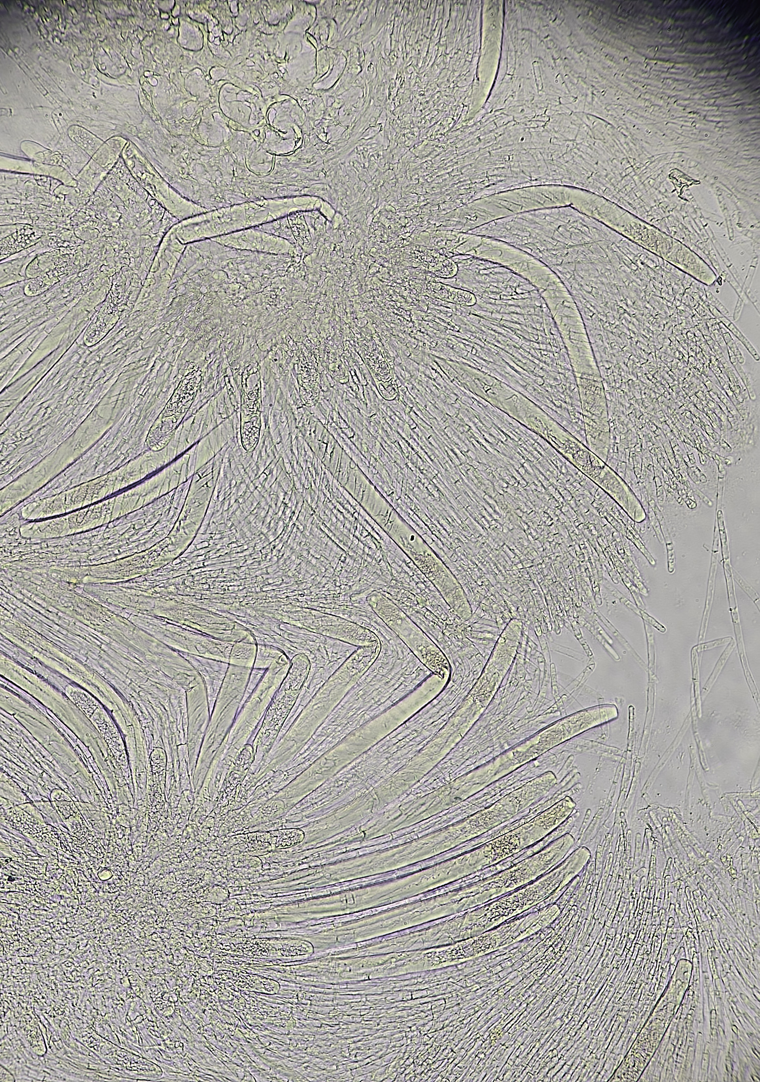 WheatfenPeziza300125-1 1
